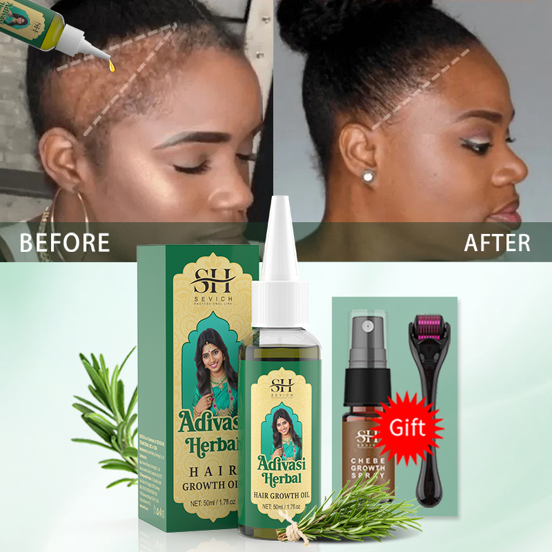 Аюрведическое масло для роста  – обзор и цена Biotin Hair Growth