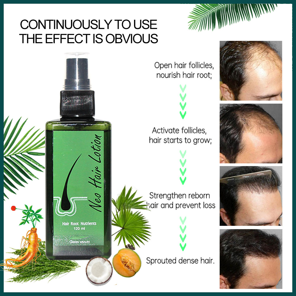 4 шт. лосьона для волос Neo Ha – обзор и цена Biotin Hair Growth